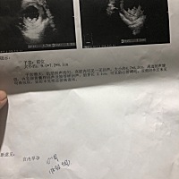 能看出男女么，有懂的给看看