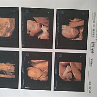 和我家大宝长得一毛一样