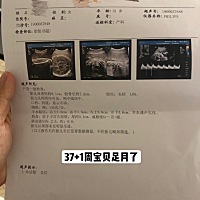 宝贝终于足月了，虽然妈妈每天晚上都睡不好，但是只要你健康，妈妈所有的累都是值得的，期待你健康来到...