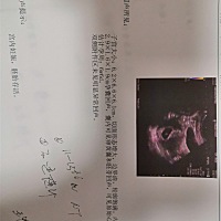 今天去孕检，医生表示一切正常