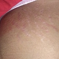 35     3  肚子花了这么多？有什么办法去除吗？