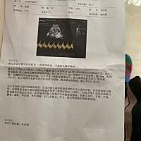 帮忙看看这个有啥问题没？17周的B超单