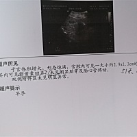 亲们我的例假一项提前，我都忘了上次来例假是什么时候了，亲们帮忙看看我这个孕囊大小应该是怀孕多少天...