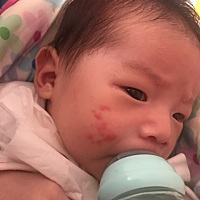 请问各位宝妈，有没有知道我儿子脸上起的红点是什么啊！宝宝刚25天，有没有宝宝类似情况的