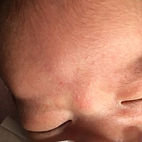 宝宝头上长了好多红点点，不知道怎么了，看着好心疼。