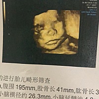 四维照片和宝宝出生后长相也差太多了吧！一直觉得宝宝脸大嘴大鼻子大怕要是女孩能丑哭 但是生下来哪里都...