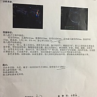 37周B超股骨长63mm算不算短？