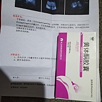 这可怎么办    最近睡的好厉害   基本是睡觉  不这样做我就要失去你  为你留下你  我什么都愿意