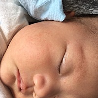 宝宝脸上有红色的点点是湿疹吗，咋办
