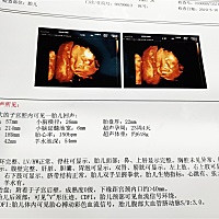 😜能看出男孩女孩不😂