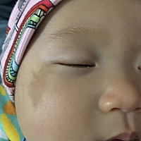 急急急、宝宝快四个月了，前段时间脸上长湿疹，睡觉睡不好，痒的扭来扭去，然后去药店买了药，医生说婴...