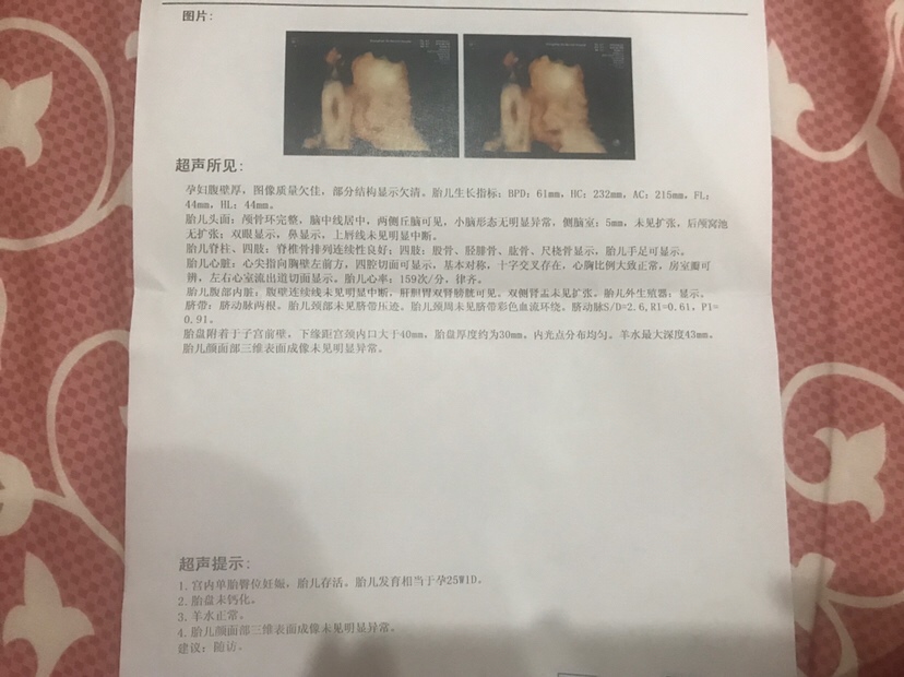 有人能看出男宝还是女宝吗？我是喜欢女宝宝的，但是我第一胎还是希望男宝宝，因为我希望女孩是要有哥哥宠着的😘