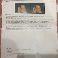 有人能看出男宝还是女宝吗？我是喜欢女宝宝的，但是我第一胎还是希望男宝宝，因为我希望女孩是要有哥哥...