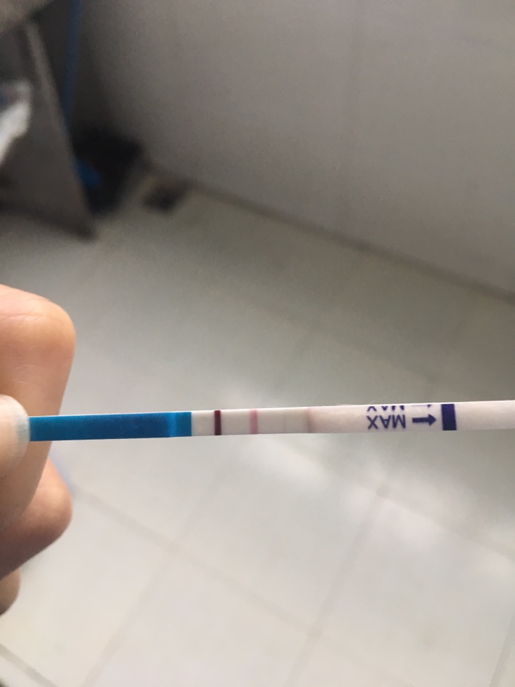 今天官方，hcg468.42孕酮68.24
小腹就跟姨妈快来之前胀痛有点像，左右中间都有过，前几天明显，这几天不咋疼了，请问正常吗？好怕宫外孕。