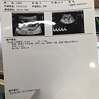 12周➕1天去检查的NT，顺利通过，但是医生说是13➕1怎么回事儿？我要按照医生说的计算吗？ 另外就是今天...