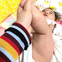 有宝妈知道这是怎么回事吗，明天带宝宝去看看类，腿上出好多呀……