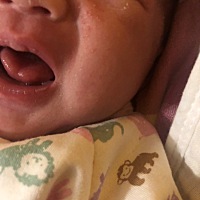 宝宝脸上起湿疹好几天了，都不好，怎么办啊