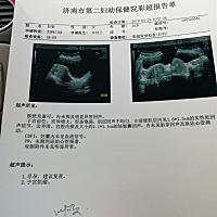 今天去检查为什么没有看到胎心，而且有子宫肌瘤，各种乱想怎么办