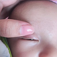 宝宝眼皮长了一个白色水泡是什么原因呀？