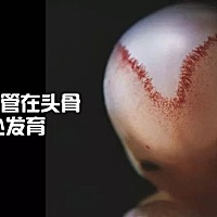 孕早期发育第三课9-12周  第9——11周：胎宝宝的面部逐渐形成，大脑的重量不断增加，进入“脑迅速增长期...