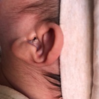 宝妈们，今天宝宝耳朵里突然发现流出白色东西，这是什么东西？