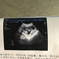 男宝女宝？ 能看懂的能看得出男宝女宝吗？谢谢🙏