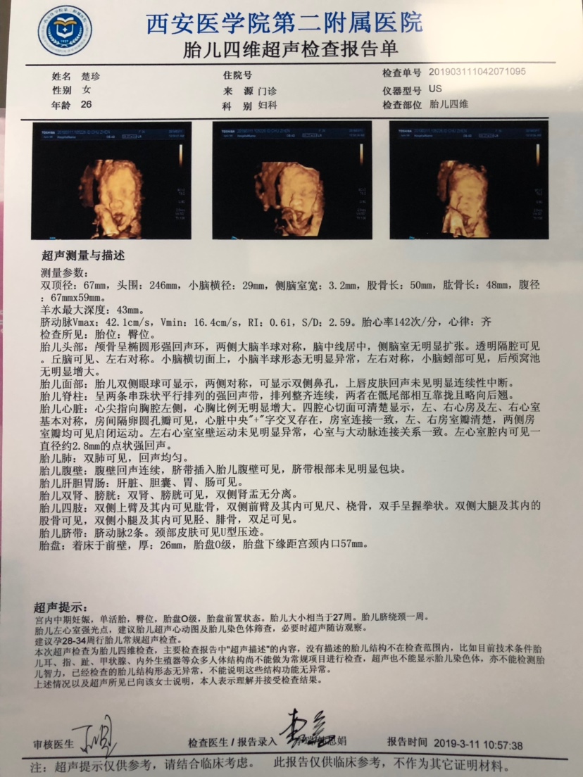 姐妹们，有经验的没，帮忙看下像男孩还是女孩，纯属好奇，谢谢啦。宝贝鼻子像我
