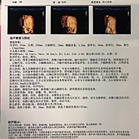 姐妹们，有经验的没，帮忙看下像男孩还是女孩，纯属好奇，谢谢啦。宝贝鼻子像我