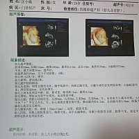 23周 4天四维，谁能看的出男女？