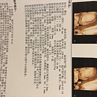 有没有会看四维单子的，给看看是男是女呀