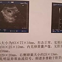 这个是男是女？