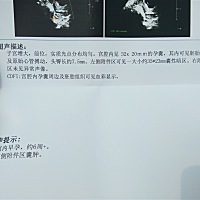 这是好的还是坏的啊，那个囊肿是什么意思，好担心，下午才拿给医生看