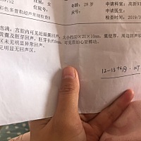 大家帮我看看是男还是女，纯属好奇 孕6周+6