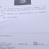 这样的情况还有必要做阴超和造影吗 毕竟我们在一起两年都没怀孕 好怕
