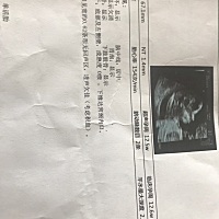 大家帮忙看看是不是女宝孕12周+5