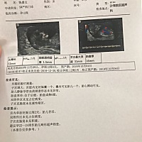 有专业人士吗？帮忙看下报告情况。