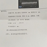 孕35 5有谁会看