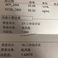 21三体综合征，1：940，医生建议做无创，有没有一样的。