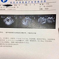 特别想知道男孩女孩！有谁能看出来吗 ？