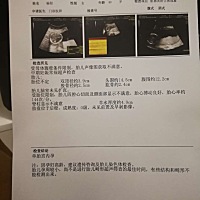 姐妹们今天我做的检查，我家老头非想知道是男宝女宝，有没有懂一点的 🙏🙏🙏