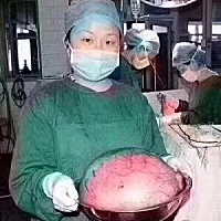 别把宫寒，痛经不当回事‼️有子宫肌瘤的注意了🦋…… 子宫肌瘤是要动手术的‼️ 一个30多岁女人...