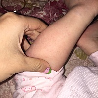有没有宝妈知道这个是什么？就今天发现的 看起来不明显也不红不痒宝宝精神跟食欲都挺好的，感觉有点像鸡...