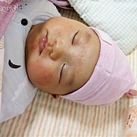 原来白白净净的脸变这样了😩宝妈们宝宝湿疹图什么好啊？