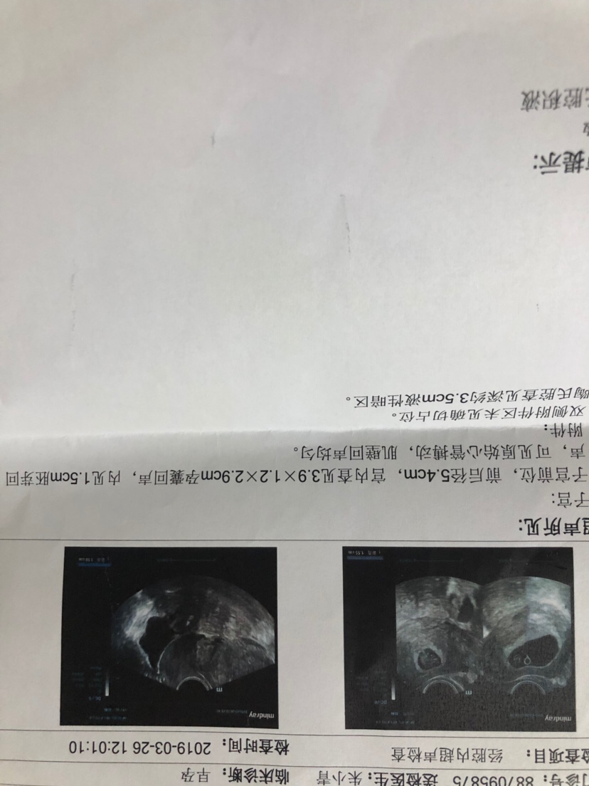 我1月28号最后来的月经，哪位能帮我看出大概受孕时间吗？谢谢