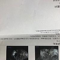 我1月28号最后来的月经，哪位能帮我看出大概受孕时间吗？谢谢