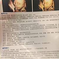 猜猜是男是女？