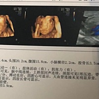 大家看看是高鼻子吗
