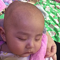 宝宝3个多月了，头上的包还没消退，生的时候说挤得…有类似的吗？