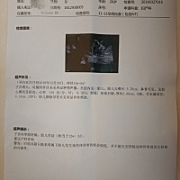 刚开始是实习医生帮我检查的，按压特别痛她说宝宝特别能动，一刻也不能停，手舞足蹈。后面是主任医生看...