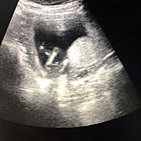 四个月了 跑去我伯伯那照男女，说现在太早了 要我等6个月😂😂 真的好好奇 乔治还是佩琦 虽然我都喜...